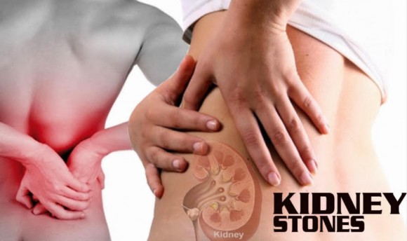 kidney pain